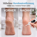 💅 1 kaufen, 1 gratis! Elektrischer Nagelfräser | Maniküre, Pediküre & Gelnägel